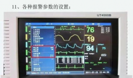 心电监护仪的操作视频,轻松掌握生命体征监测技巧